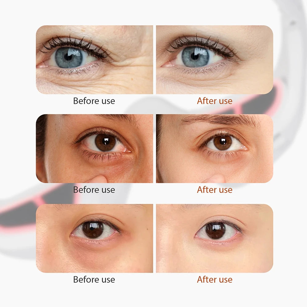 Eye Care Beauty Machine